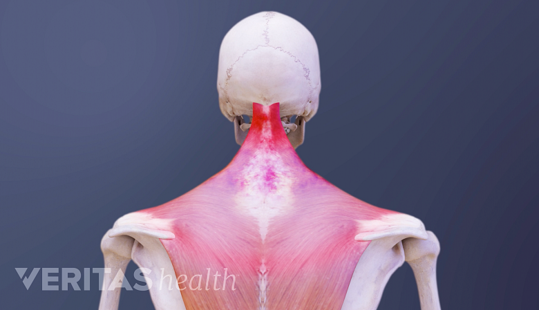 What Can Neck Pain Mean?