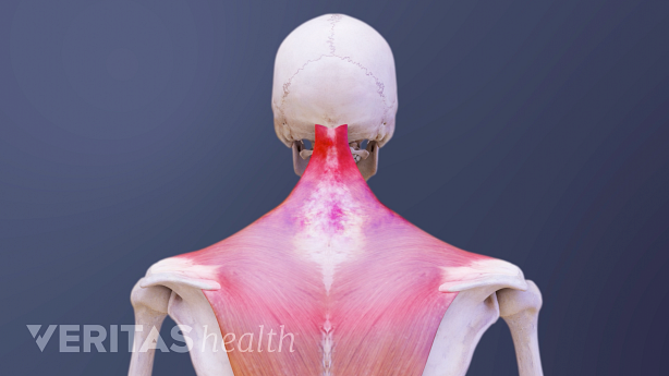 Illustration showing back of the neck highlighted in red.