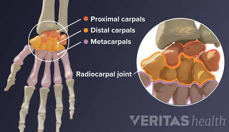 Dorsal view of the proximal, distal, and metacarpal wrist bones.