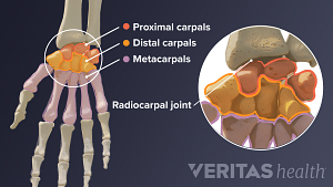 Dorsal view of the proximal, distal, and metacarpal wrist bones.