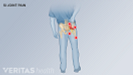 说明代表疼痛模式如果关节疼痛的背部和大腿在右边。