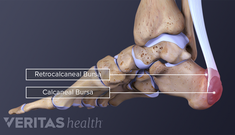 Calcaneal and retrocalcaneal bursas in the ankle.