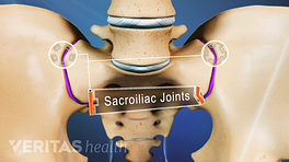 Anterior view of the sacroiliac joints in the pelvis