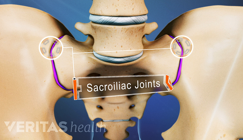 Anterior view of the pelvis labeling the SI Joints.