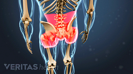 Illustrated skeleton highlighting pain in the buttock, hip, and lower back