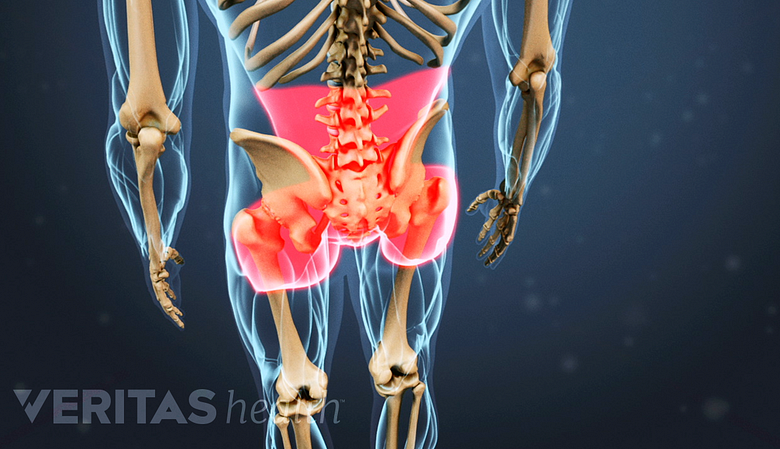 red highlight in the lower back and buttock area depicting axial back pain.