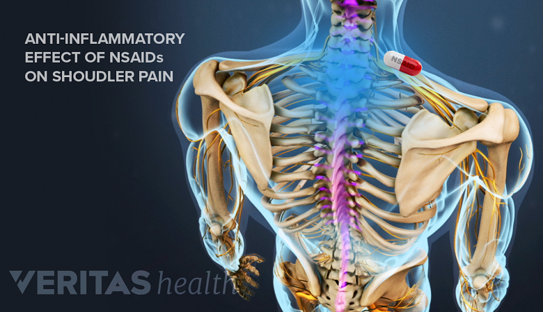 Illustration showing affects of NSAIDs on the shoulder pain.