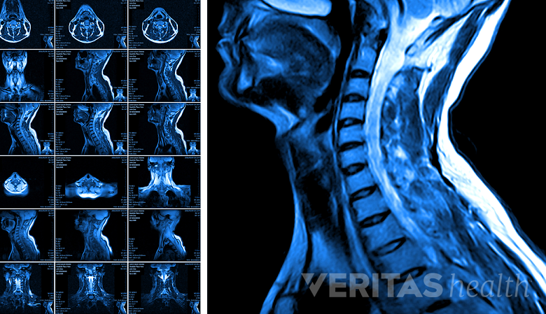 Illustration showing MRI scan of head and neck.