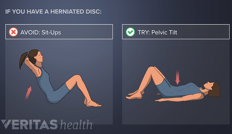 Avoid sit ups with lower back disc herniation. Try Pelvic Tilts