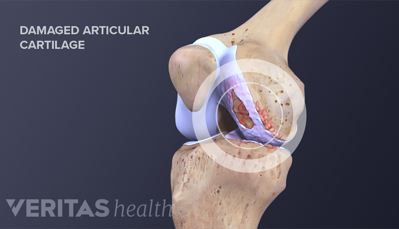 What is Cartilage?
