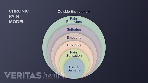 A diagram explaining the chronic pain model