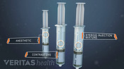 Three syringes used as a lumbar epidural steroid injection