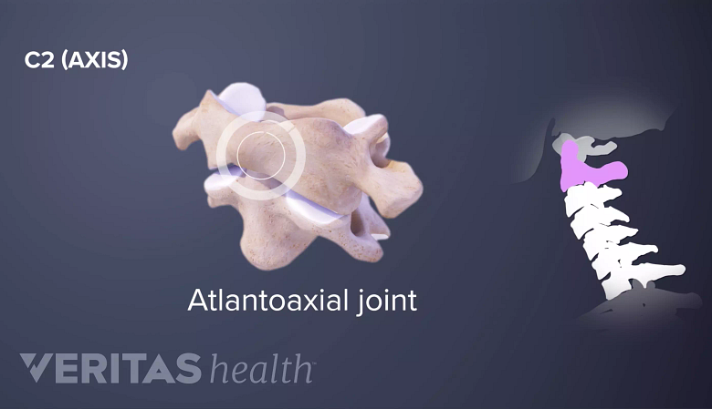 3D rendering of the atlantoaxial joint as seen from the side, next to silhouette of the cervical spine.