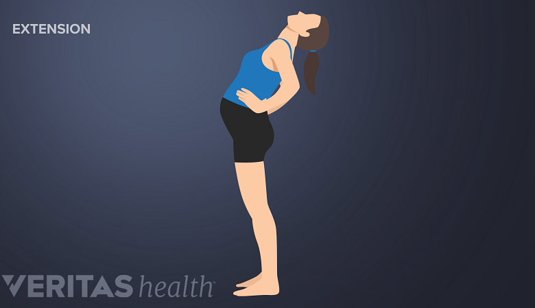 McKenzie method back exercise extension in standing or bending backward.
