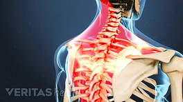 Posterior view of upper body with pain highlighted in the shoulders