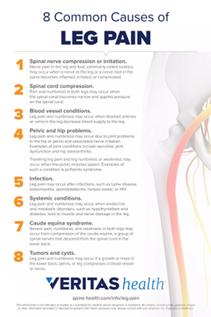 Infographic of 8 Causes of Leg Pain