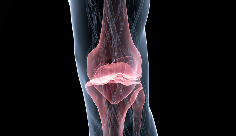 Pain symptoms in the knee.