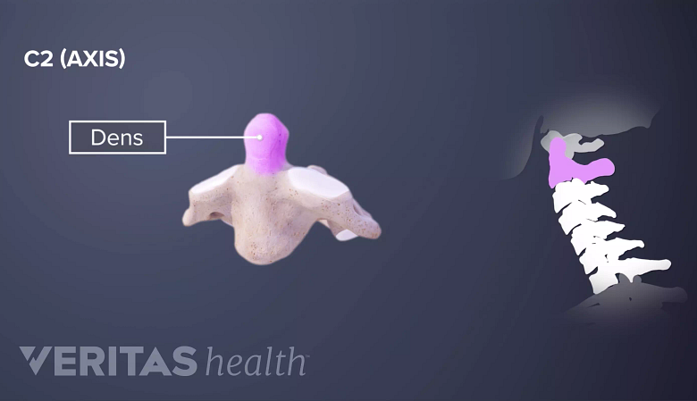 Medical illustration of the odontoid process on the C2 cervical vertebra