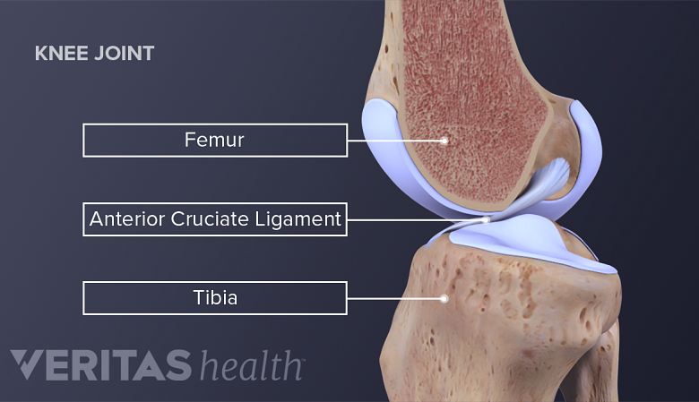 Knee joint anatomy showing femur, tibia and ACL.