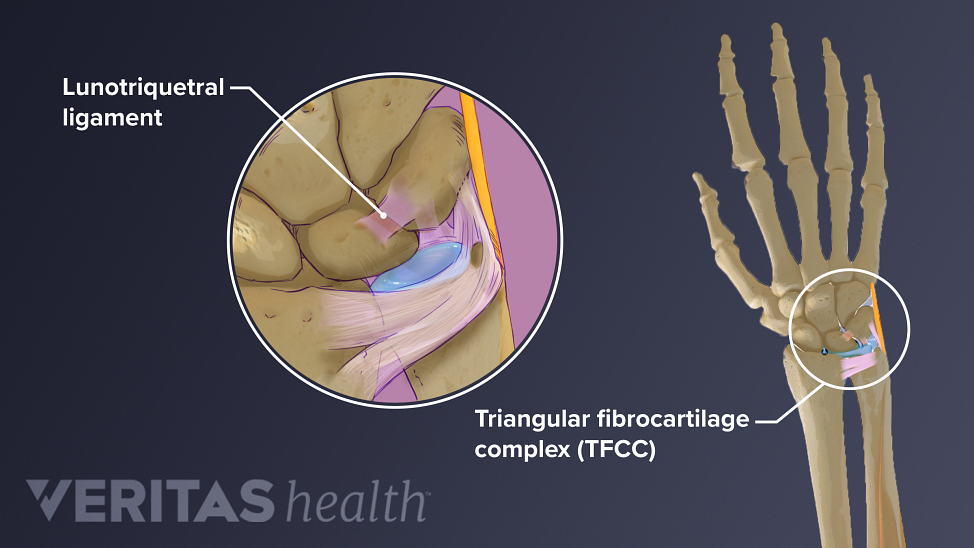 Illustration of the triangular fibrocartilage complex FCC