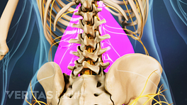 Posterior view fo the lower back focused on the pain in the low back muscles.