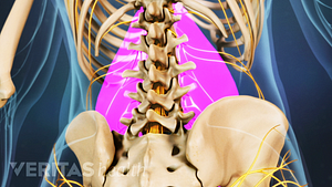 Vista posterior de la zona lumbar destacando el dolor en la columna lumbar.