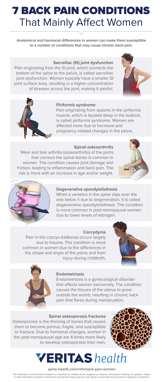 Revealed: Causes of Lower Back Pain among the Women