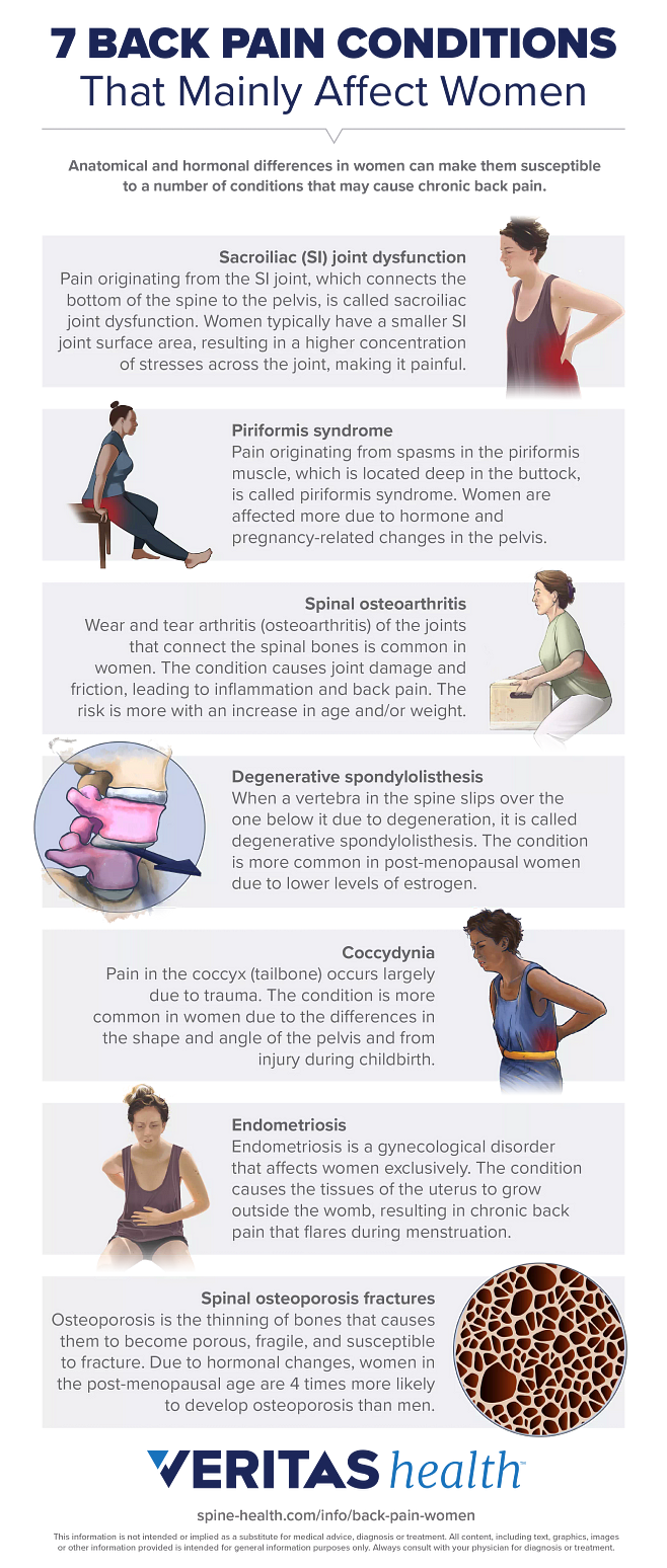 Infographic of 7 Back Pain Conditions that Affect Mostly Women