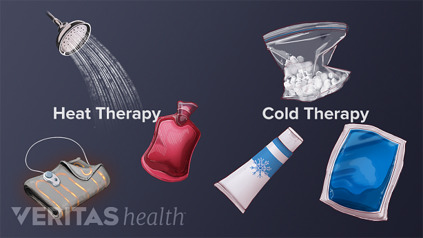 An illustration showing various ice and heat therapy techniques.