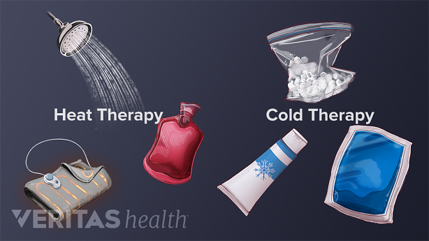 Medical illustration of the different types of heat and cold therapies including hot water bottle, hot shower, heating pad, bag of ice, ice pack, cooling cream