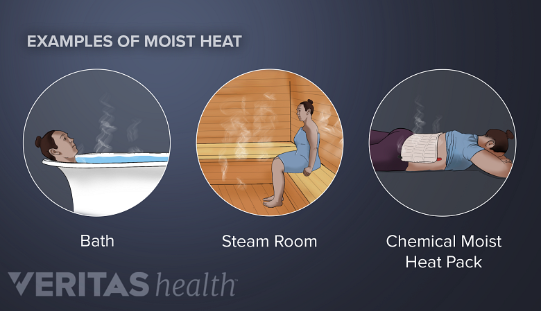 Types of moist heat.