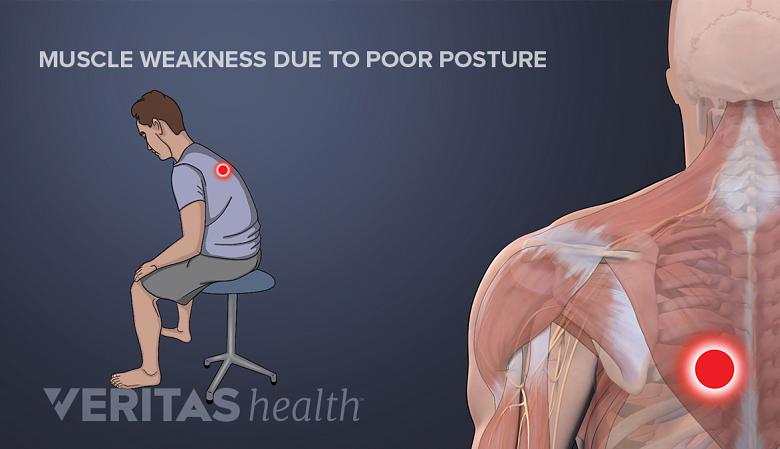 Illustration showing a man  sitting with a poor posture with a red dot in his upper back area.