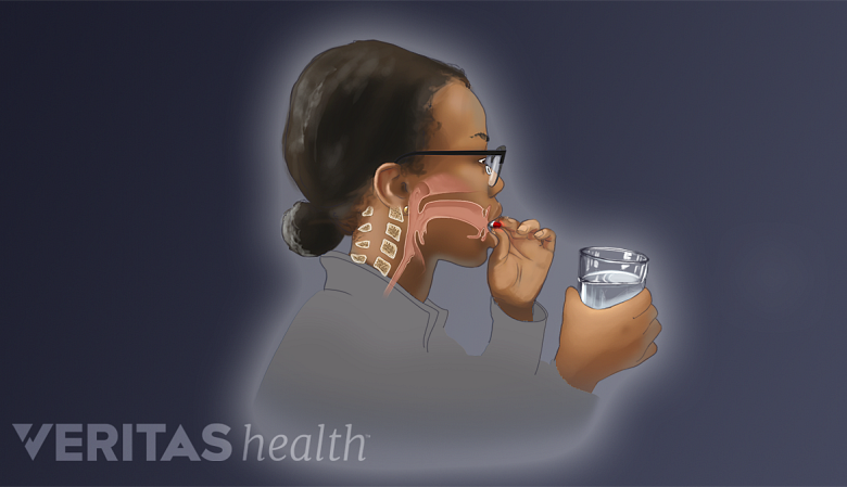 Illustration showing a woman swallowing  a pill.