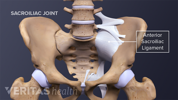 Anterior view of the pelvis highlighting the Iliolumbar ligament, anterior sacroiliac ligament, sacrotuberous ligament, and sacroiliac joint.