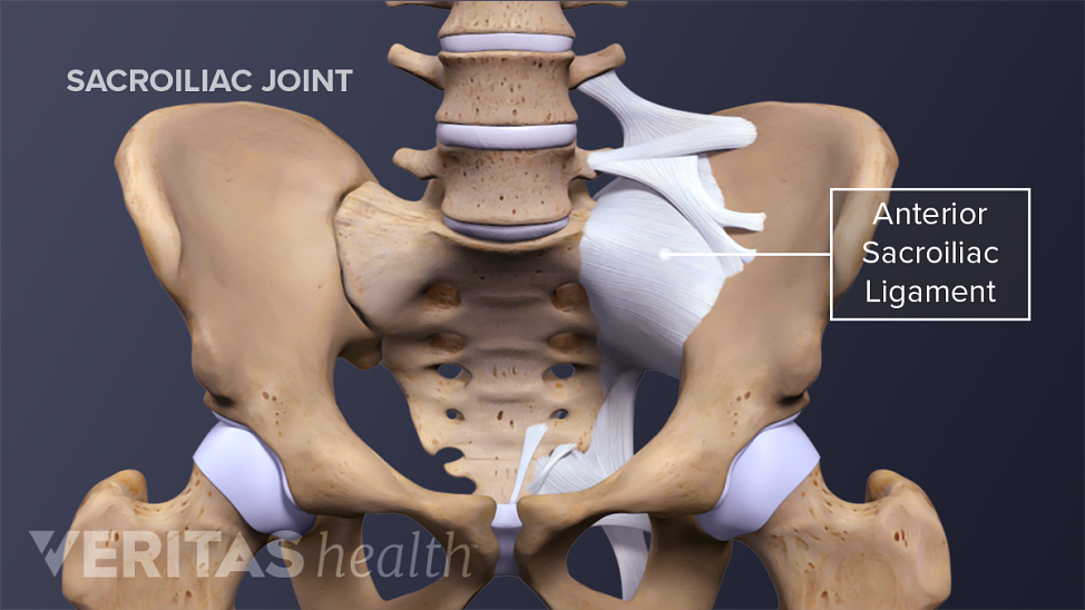 Anterior view of the SI JoInt labeling anterior sacroiliac ligament