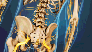 Medical illustration of the lower spine and hips, showing bones and nerves