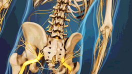 Medical illustration of the lower spine and hips, showing bones and nerves