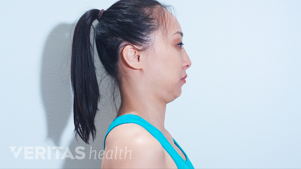 Woman practicing a chin tuck for neck pain relief