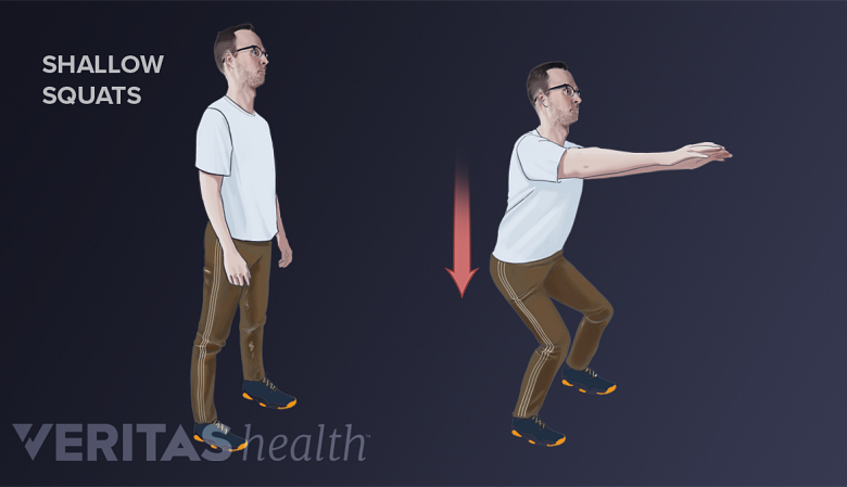 Medical illustration of shallow squat exercise