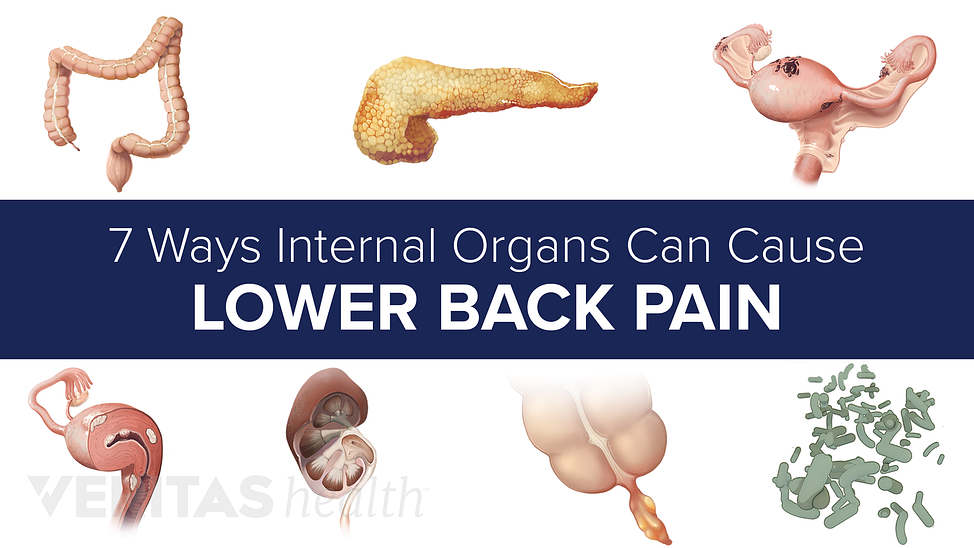 Lower Right Back Pain from Internal Organs