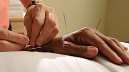 Acupuncture needles being placed in the hand