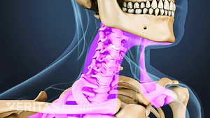 Medical illustration of the cervical spine. The location of muscles in the neck are highlighted in pink.
