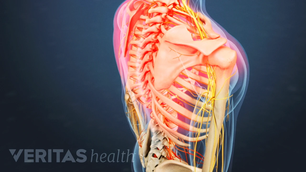 Upper Back Pain Spine Health