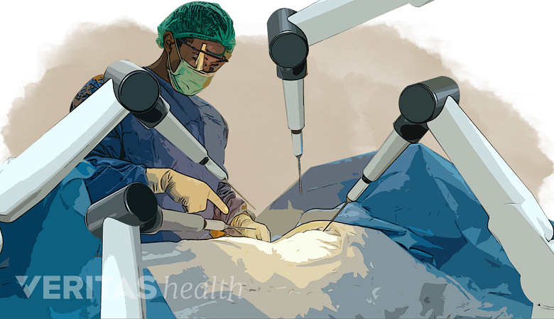 An illustration showing a doctor performing surgery in the operating room.