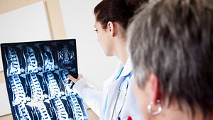 Doctors examining scans of patient&#039;s spine.