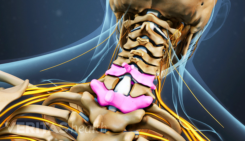 Illustration showing posterior view of cervical vertebra.