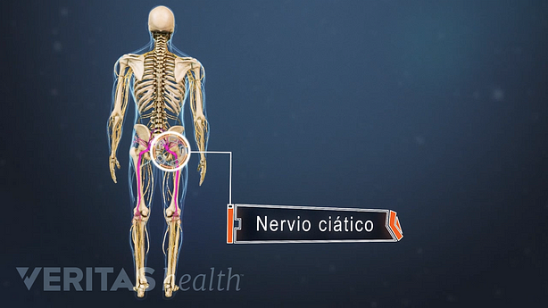 Posterior view of the body labeling the sciatic nerve in the pelvis.