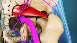 Síndrome Piriforme en la articulación de la cadera.