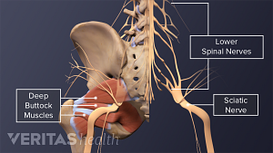 The lower back and pelvis highlghting the deep pelvic muscles, lumbar spinal nerves, and the sciatic nerve.