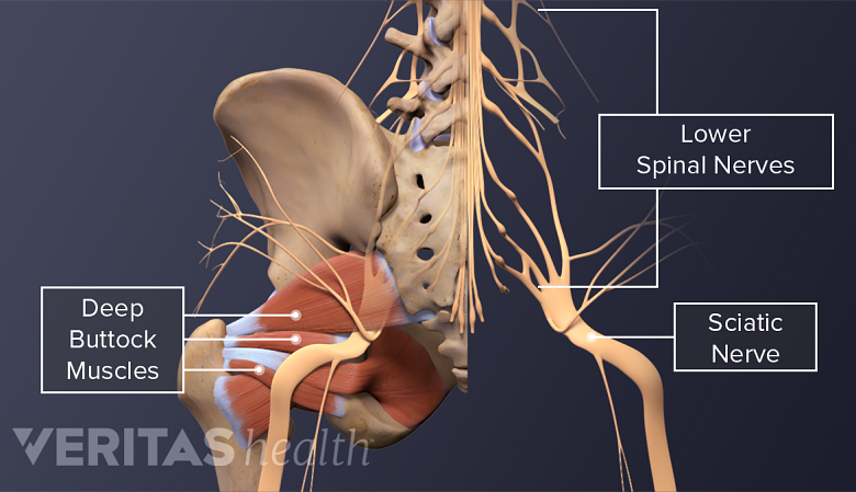 Image showing spinal nerves merging into the sciatic nerve in the lower spine and the deep buttock muscles.